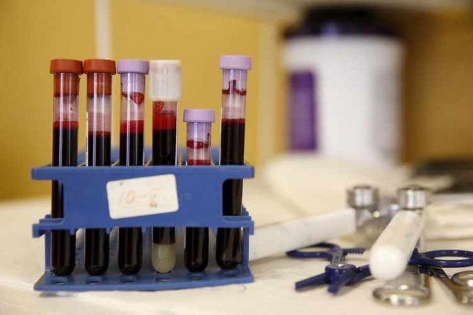 علماء ينجحون في الحصول على الكهرباء من دم الإنسان